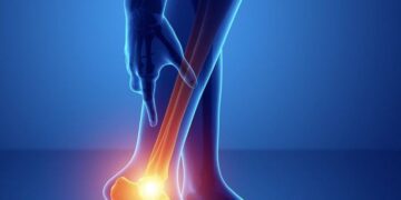 ضربه به مچ پا